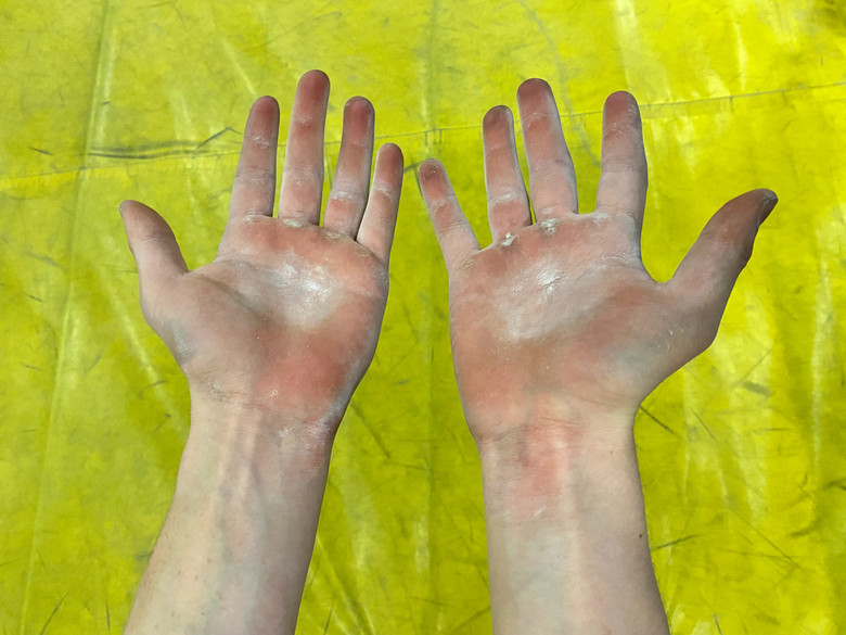 Handinnenflächen eines Kletterers mit Magnesium und Schwielen vor einem gelben Hintergrund.